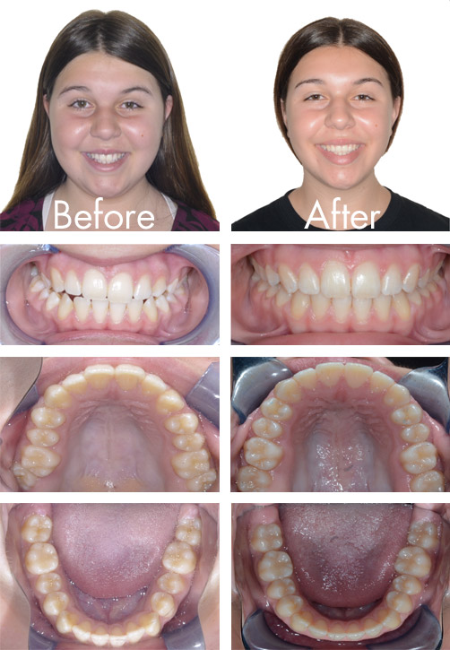 Patient before and after picture